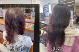 2年間の髪質改善のビフォーアフター写真 